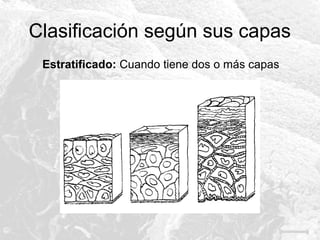 Clasificación según sus capas
Estratificado: Cuando tiene dos o más capas

 