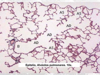 Epitelio, Alvéolos pulmonares. 10x.

 
