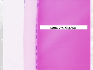 Lente, Ojo, Rata. 40x.

 