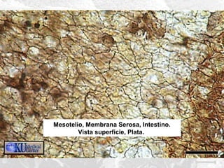 Mesotelio, Membrana Serosa, Intestino.
Vista superficie, Plata.

 