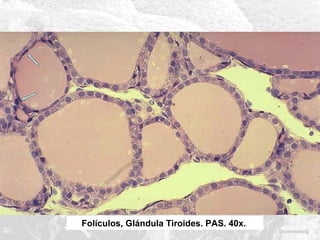 Folículos, Glándula Tiroides. PAS. 40x.

 