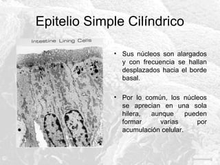 Epitelio Simple Cilíndrico
• Sus núcleos son alargados
y con frecuencia se hallan
desplazados hacia el borde
basal.
• Por lo común, los núcleos
se aprecian en una sola
hilera,
aunque
pueden
formar
varias
por
acumulación celular.

 
