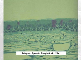 Tráquea, Aparato Respiratorio. 20x.

 