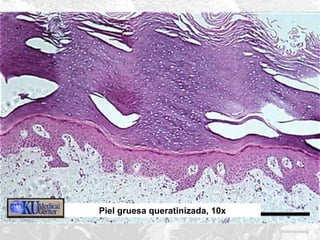 Piel gruesa queratinizada, 10x

 