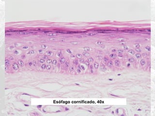 Esófago cornificado, 40x

 