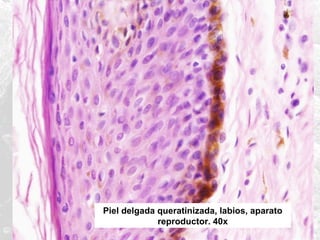 Piel delgada queratinizada, labios, aparato
reproductor. 40x

 