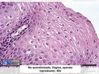 No queratinizado, Vagina, aparato
reproductor. 40x

 