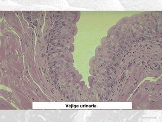 Vejiga urinaria.

 