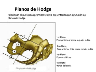 Planos de Hodge
Relacionar el punto mas prominente de la presentación con alguno de los
planos de Hodge
1er Plano
Promontorio a borde sup. del pubis
2do Plano
Cara anterior 2S a borde inf. del pubis
3er Plano
Espinas ciáticas
4to Plano
Borde del coxis
 