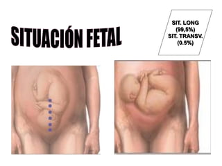 SIT. LONG
(99,5%)
SIT. TRANSV.
(0.5%)
 