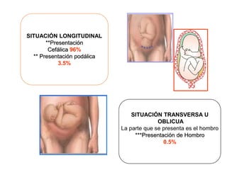 SITUACIÓN LONGITUDINAL
**Presentación
Cefálica 96%
** Presentación podálica
3.5%
SITUACIÓN TRANSVERSA U
OBLICUA
La parte que se presenta es el hombro
***Presentación de Hombro
0.5%
 