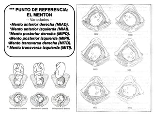 *** PUNTO DE REFERENCIA:
EL MENTON
-- Variedades –
•Mento anterior derecha (MIAD).
*Mento anterior izquierda (MIAI).
*Mento posterior derecha (MIPD).
•Mento posterior izquierda (MIPI).
•Mento transversa derecha (MITD).
* Mento transversa izquierda (MITI).
 
