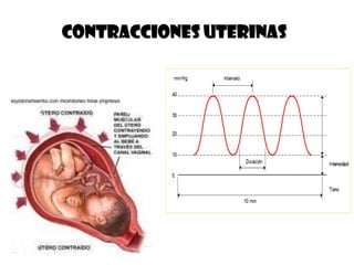 CONTRACCIONES UTERINAS
 
