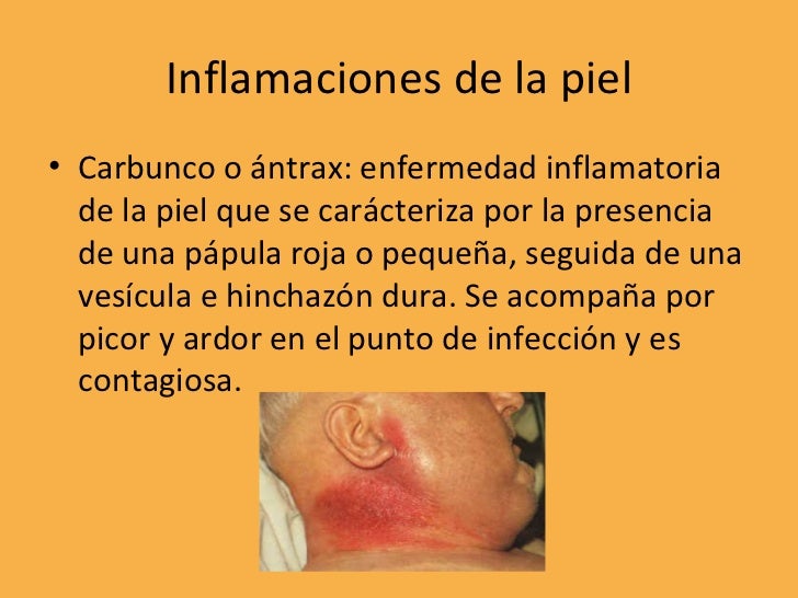 Inflamacion De La Piel Termino Medico