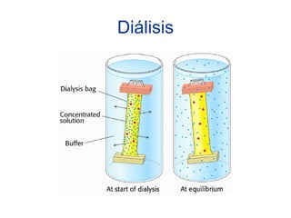 Diálisis
 
