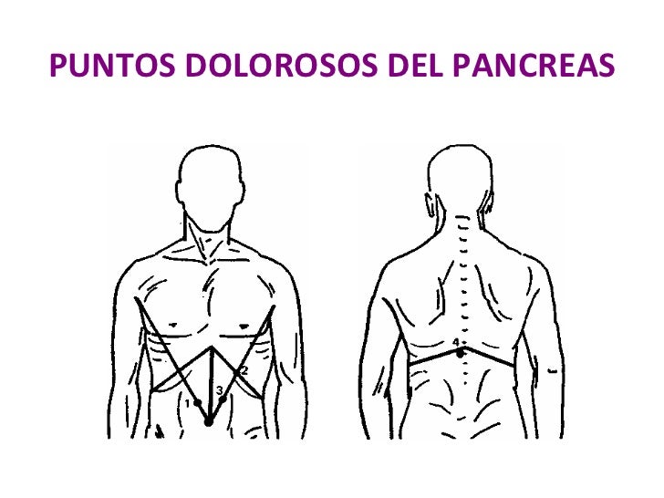 Resultado de imagen para Puntos biliares y pancreÃ¡ticos