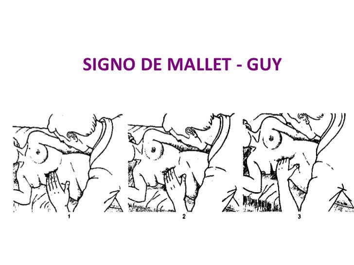 Clase 5 b semiologia de pancreas y vias biliares