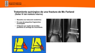 Universidad Nacional
Federico Villarreal
Tratamiento quirúrgico de una fractura de Mc Farland
(Salter IV del maléolo interno)
• Necesita una reducción anatómica
• En caso de pequeños fragmentos:
enclavijado
• O fijación por medio de tornillos
paralelos al cartílago de crecimiento
 