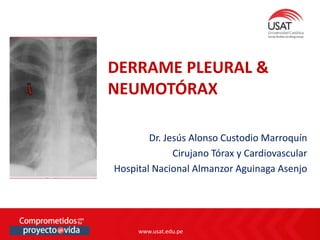 www.usat.edu.pe
www.usat.edu.pe
Dr. Jesús Alonso Custodio Marroquín
Cirujano Tórax y Cardiovascular
Hospital Nacional Almanzor Aguinaga Asenjo
DERRAME PLEURAL &
NEUMOTÓRAX
 