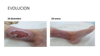 EVOLUCION
24 diciembre 24 enero
 