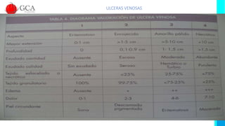 ULCERAS VENOSAS
 