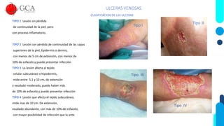 ULCERAS VENOSAS
CLASIFICACION DE LAS ULCERAS
TIPO 1 Lesión sin pérdida
de continuidad de la piel, pero
con proceso Inflamatorio.
TIPO 2 Lesión con pérdida de continuidad de las capas
superiores de la piel, Epidermis o dermis,
con menos de 5 cm de extensión, con menos de
10% de esfacelo y puede presentar infección
TIPO 3 La lesión afecta al tejido
celular subcutáneo o hipodermis,
mide entre 5,1 y 10 cm, de extensión
y exudado moderado, puede haber más
de 10% de esfacelo y puede presentar infección
TIPO 4 Lesión que afecta el tejido subcutáneo,
mide mas de 10 cm. De extensión,
exudado abundante, con más de 10% de esfacelo,
con mayor posibilidad de infección que la ante
Tipo I
Tipo II
Tipo III
Tipo IV
 