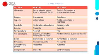ULCERAS VENOSAS
 