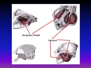 Pterigoideo Medial
Masétero

 