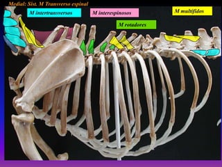 Medial: Sist. M Transverso espinal
M intertransversos

M interespinosos
M rotadores

M multífidos

 