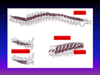 Multífidos

Interespinosos

Intertransversos

Rotadores

 