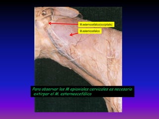 M.esternocefalico(occipitalis)
M.esternocefalico

Para observar los M epiaxiales cervicales es necesario
extirpar el M. esterneocefálico

 