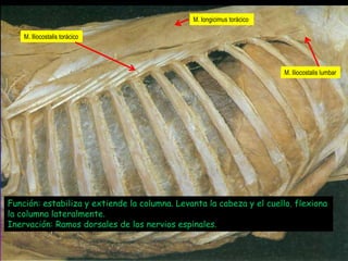 M. Iongicimus torácico

M. Iliocostalis torácico

M. Iliocostalis lumbar

Función: estabiliza y extiende la columna. Levanta la cabeza y el cuello. flexiona
la columna lateralmente.
Inervación: Ramos dorsales de los nervios espinales.

 