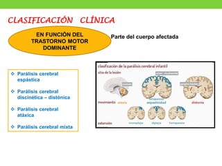 CLASIFICACIÓN CLÍNICA
EN FUNCIÓN DEL
TRASTORNO MOTOR
DOMINANTE
Parte del cuerpo afectada
❖ Parálisis cerebral
espástica
❖ Parálisis cerebral
discinética – distónica
❖ Parálisis cerebral
atáxica
❖ Parálisis cerebral mixta
 