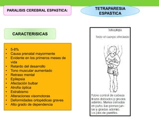 PARALISIS CEREBRAL ESPASTICA:
CARACTERISICAS
• 5-8%
• Causa prenatal mayormente
• Evidente en los primeros meses de
vida
• Retardo del desarrollo
• Tono muscular aumentado
• Retraso mental
• Epilepsia
• Afectación bulbar
• Atrofia óptica
• Estrabismo
• Alteraciones visomotoras
• Deformidades ortopédicas graves
• Alto grado de dependencia
TETRAPARESIA
ESPASTICA
 