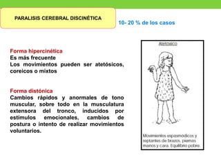 PARALISIS CEREBRAL DISCINÉTICA
10- 20 % de los casos
Forma hipercinética
Es más frecuente
Los movimientos pueden ser atetósicos,
coreicos o mixtos
Forma distónica
Cambios rápidos y anormales de tono
muscular, sobre todo en la musculatura
extensora del tronco, inducidos por
estímulos emocionales, cambios de
postura o intento de realizar movimientos
voluntarios.
 