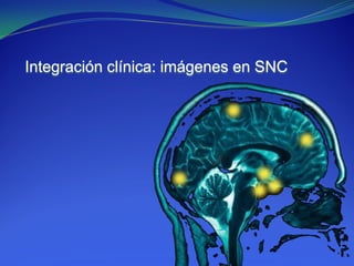 Integración clínica: imágenes en SNC
 