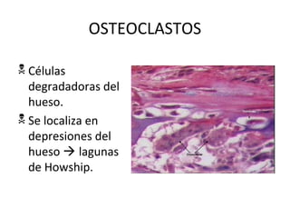 OSTEOCLASTOS
 Células
degradadoras del
hueso.
 Se localiza en
depresiones del
hueso  lagunas
de Howship.
 