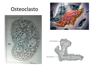 Osteoclasto
 