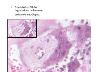 • Osteoclastos: Células
degradadoras de hueso se
derivan de macrófagos.
 