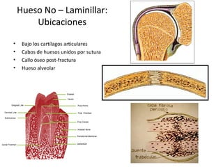 Hueso No – Laminillar:
Ubicaciones
• Bajo los cartílagos articulares
• Cabos de huesos unidos por sutura
• Callo óseo post-fractura
• Hueso alveolar
 
