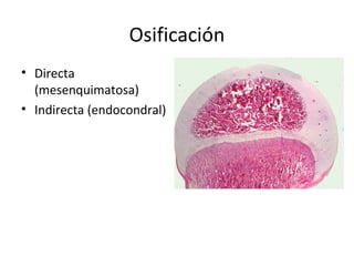 Osificación
• Directa
(mesenquimatosa)
• Indirecta (endocondral)
 