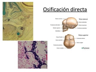 Osificación directa
 