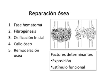 Reparación ósea
1. Fase hematoma
2. Fibrogénesis
3. Osificación Inicial
4. Callo óseo
5. Remodelación
ósea Factores determinantes
•Exposición
•Estímulo funcional
 
