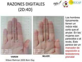 RAZONES DIGITALES
     (2D:4D)
                                      Los hombres
                                      típicamente
                                      tienen un
                                      índice más
                                      corto que el
                                      anular. En las
                                      mujeres son
                                      parecidos o al
                                      revés. Esto
                                      parece ser un
                                      marcador de
                                      exposición a
                                      testosterona
    VARON                     MUJER   prenatal
Wilson Rahman 2005 Born Gay
 
