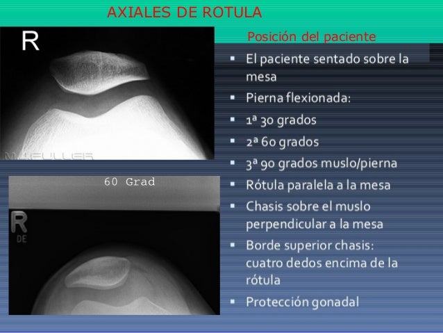 Rx Assiale Rotula 30 60 90 extremidades inferiores