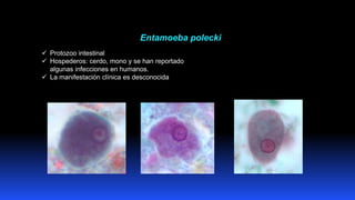 Entamoeba polecki
✓ Protozoo intestinal
✓ Hospederos: cerdo, mono y se han reportado
algunas infecciones en humanos.
✓ La ...