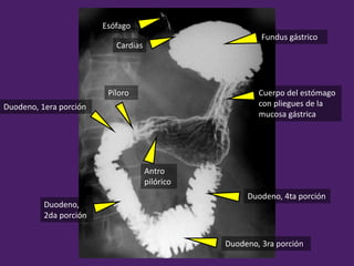 Fundus gástrico
Cuerpo del estómago
con pliegues de la
mucosa gástrica
Duodeno, 1era porción
Duodeno,
2da porción
Duodeno, 3ra porción
Duodeno, 4ta porción
Píloro
Cardias
Antro
pilórico
Esófago
 
