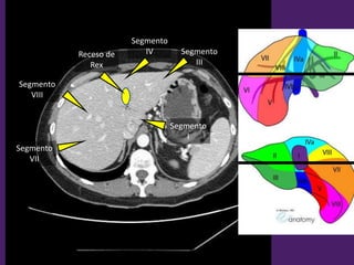 Segmento
III
Segmento
IV
Segmento
VII
Segmento
VIII
Segmento
I
Receso de
Rex
 