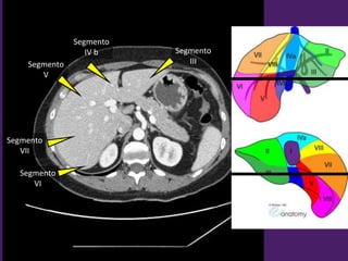 Segmento
III
Segmento
IV b
Segmento
VII
Segmento
V
Segmento
VI
 
