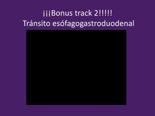 ¡¡¡Bonus track 2!!!!!
Tránsito esófagogastroduodenal
 